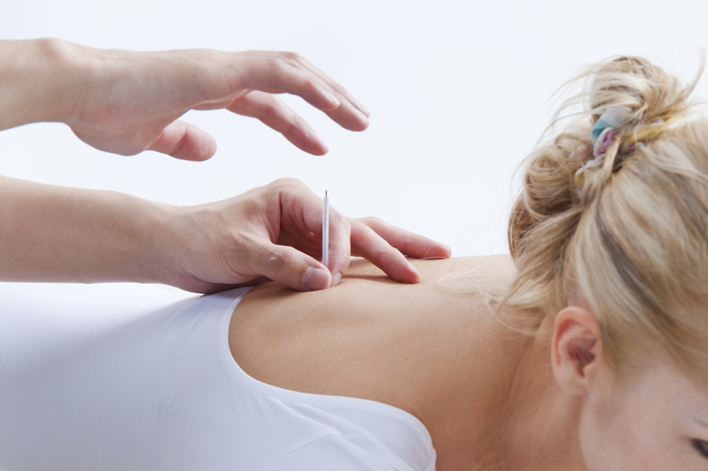 How Does Acupuncture Work and the Benefits and the Use of ...